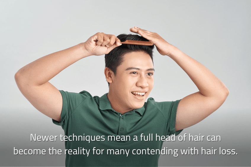 Newer techniques mean a full head of hair can become the reality 