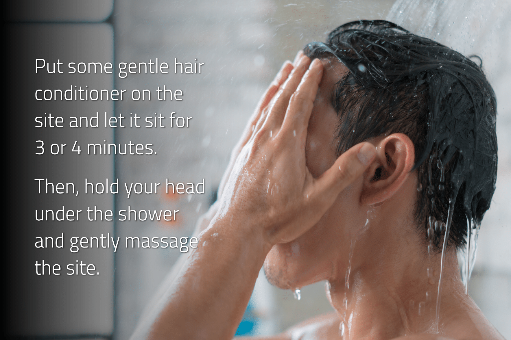 How to Wash Your Hair After a Hair Transplant Surgery