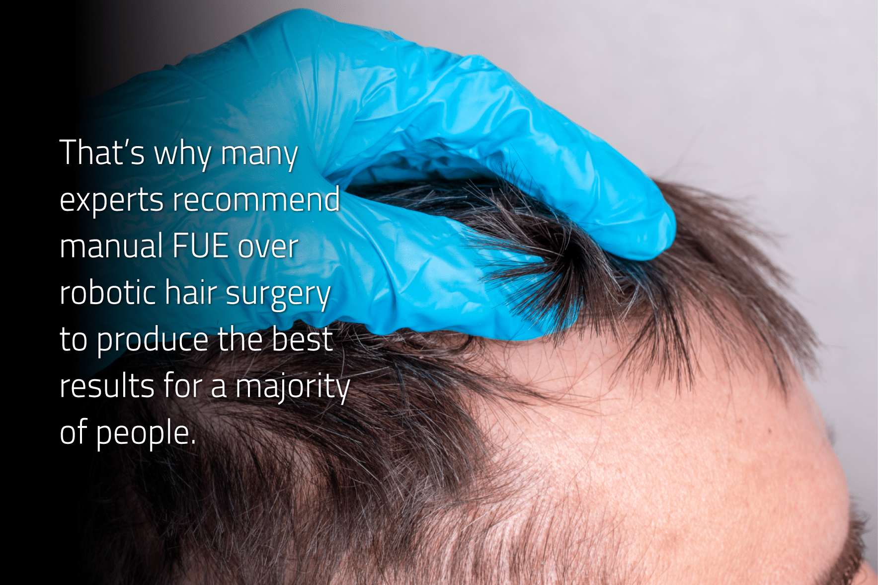 Why many experts recommend manual FUE over robotic hair surgery